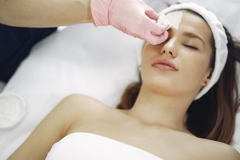 chemical peel treatment